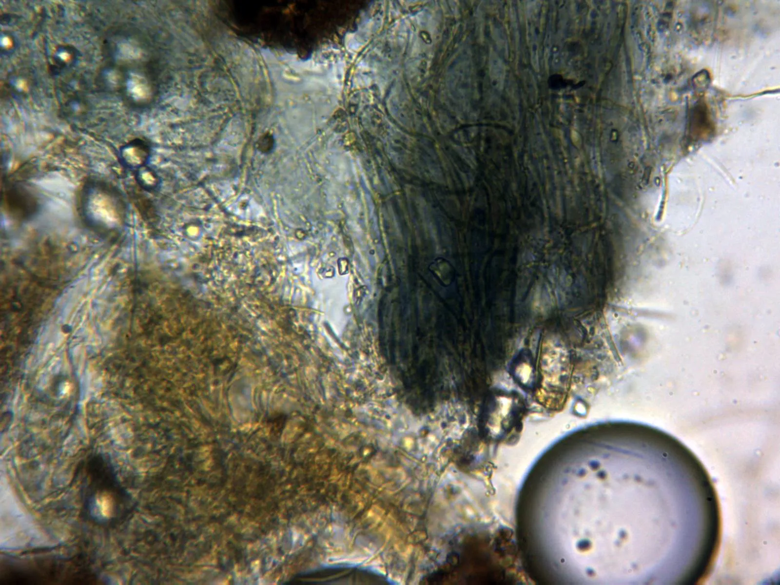 Microscopía de Ostropa barbara - 11 - IKI x 400